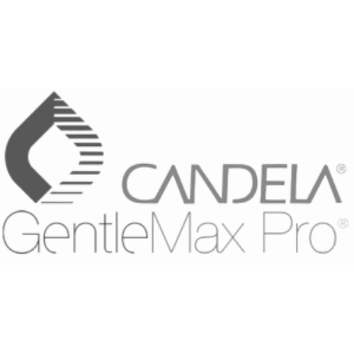 Candela Gentle Max Pro at Metro Laser.